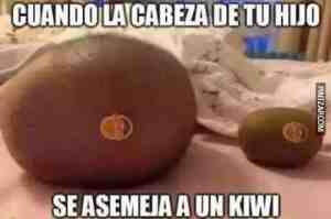 Cuando la cabeza de tu hijo se parece a un kiwi